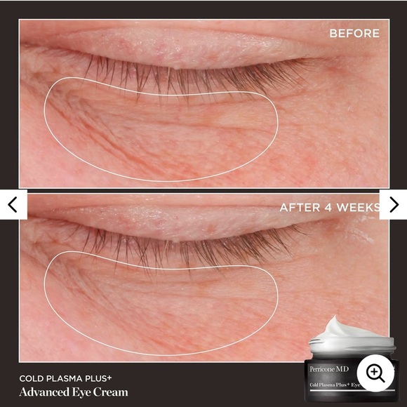 NIB•Perricone MD Cold Plasma Plus+ Eye - Picture 2 of 4